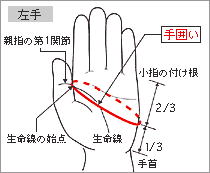 手囲い